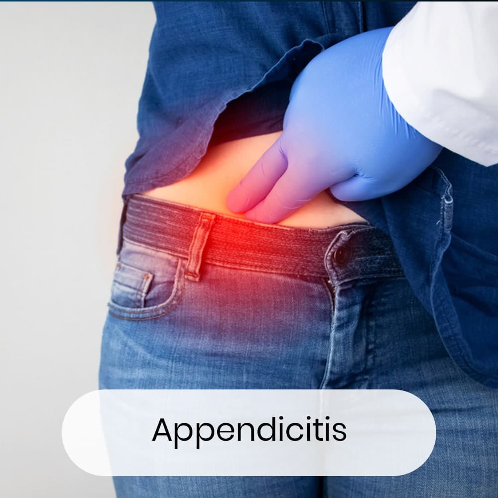 Appendicitis-min